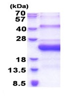 SDS-PAGE - Recombinant Human SMCP protein (His tag N-Terminus) (AB171603)