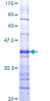 SDS-PAGE - Recombinant Human Smg1 protein (GST tag N-Terminus) (AB161516)