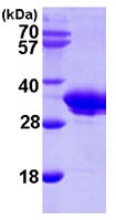 SDS-PAGE - Recombinant Human SMNDC1 protein (His tag N-Terminus) (AB102020)