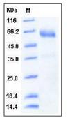 SDS-PAGE - Recombinant Human SMOC1 protein (His tag) (AB276453), expandable thumbnail