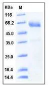 SDS-PAGE - Recombinant Human SMOC1 protein (His tag) (AB276453)