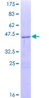 SDS-PAGE - Recombinant Human Smoothened protein (AB114221)