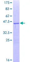 SDS-PAGE - Recombinant Human Smoothened protein (GST tag N-Terminus) (AB114221)