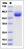 SDS-PAGE - Recombinant Human SMPDL3A protein (His tag) (AB276559)