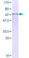 Recombinant Human SMPDL3B protein