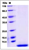 SDS-PAGE - Recombinant Human SMR3B protein (His tag) (AB276543), expandable thumbnail