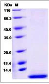 SDS-PAGE - Recombinant Human SMR3B protein (His tag) (AB276543)
