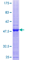 SDS-PAGE - Recombinant Human SMUG1 protein (AB132162)