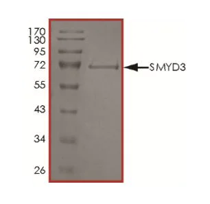 SDS-PAGE - Recombinant human SMYD3 protein (Active) (AB268976)