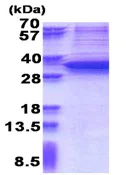SDS-PAGE - Recombinant Human SNAIL protein (denatured) (AB176060)