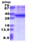 SDS-PAGE - Recombinant Human SNAIL protein (denatured) (His tag N-Terminus) (AB176060)