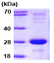 SDS-PAGE - Recombinant Human SNAP23 protein (AB79180)