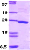 SDS-PAGE - Recombinant Human SNAP25 protein (Tag Free) (AB74529)