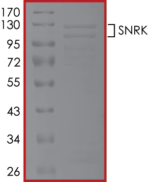 SDS-PAGE - Recombinant human SNRK protein (Active) (AB204151)