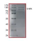 SDS-PAGE - Recombinant human SNRK protein (Active) (AB204151)