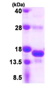 SDS-PAGE - Recombinant Human SNRNP25 protein (AB107142)