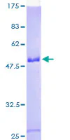 SDS-PAGE - Recombinant Human SNRP70/U1-70K protein (AB132548)
