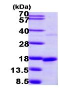 SDS-PAGE - Recombinant Human SNRPD2 protein (His tag N-Terminus) (AB104481)