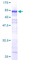 Recombinant Human SNX25 protein