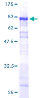 SDS-PAGE - Recombinant Human SNX25 protein (AB164461)