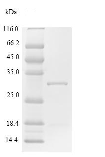 Recombinant Human SOCS1 protein (His tag)