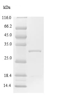 SDS-PAGE - Recombinant Human SOCS1 protein (His tag) (AB226430)
