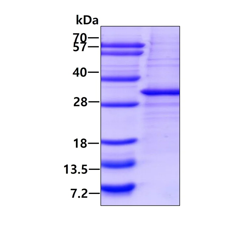 SDS-PAGE - Recombinant Human SOCS3 protein (denatured) (AB177638)