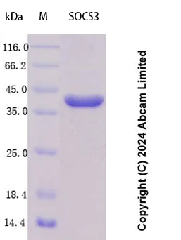 SDS-PAGE - Recombinant Human SOCS3 Protein Standard (His tag) (AB323075)