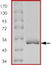 SDS-PAGE - Recombinant Human SOD2/MnSOD protein (AB84639), expandable thumbnail