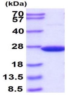 SDS-PAGE - Recombinant human SOD2/MnSOD protein (AB93946), expandable thumbnail