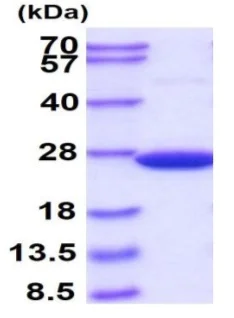 SDS-PAGE - Recombinant human SOD2/MnSOD protein (His tag N-Terminus) (AB93946)