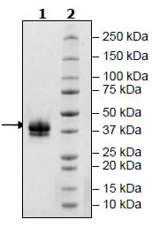 SDS-PAGE - Recombinant Human soluble IL2 Receptor beta protein (Avi tag C-Terminus + His tag C-Terminus) (AB271552)