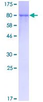 SDS-PAGE - Recombinant Human Soluble TNF Receptor II protein (GST tag N-Terminus) (AB132049)