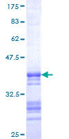 SDS-PAGE - Recombinant Human Somatostatin protein (GST tag N-Terminus) (AB159587)
