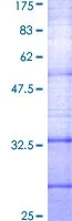 SDS-PAGE - Recombinant Human Somatostatin Receptor 2 protein (AB114373)