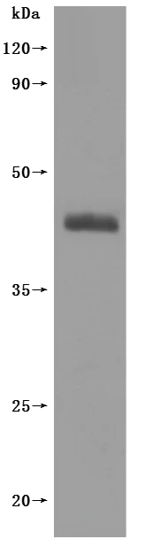 Western blot - Recombinant human Somatostatin Receptor 2 protein - Active (His tag) (AB314535)