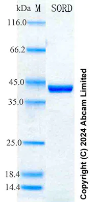 SDS-PAGE - Recombinant Human Sorbitol Dehydrogenase Protein Standard (His tag) (AB316737)