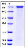 SDS-PAGE - Recombinant Human SorCS1 protein (His tag) (AB276446)