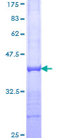 Recombinant Human SorLA/SORL1 protein