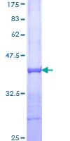 SDS-PAGE - Recombinant Human SorLA/SORL1 protein (GST tag N-Terminus) (AB114683)