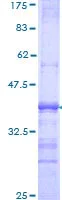 SDS-PAGE - Recombinant Human Sortilin/NT3 protein (AB114233)