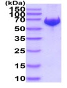 SDS-PAGE - Recombinant Human SOS1 protein (His tag) (AB233594), expandable thumbnail