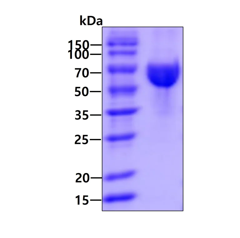 SDS-PAGE - Recombinant Human SOS1 protein (His tag C-Terminus) (AB233594)