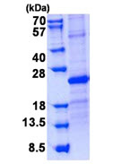 SDS-PAGE - Recombinant Human SOSTDC1 protein (denatured) (His tag N-Terminus) (AB139616)