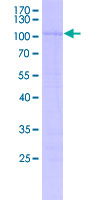 SDS-PAGE - Recombinant Human SOX17 protein (GST tag N-Terminus) (AB253177)