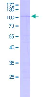SDS-PAGE - Recombinant Human SOX17 protein (Tagged) (AB253177)