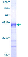 Recombinant Human SOX6 protein
