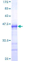 SDS-PAGE - Recombinant Human SOX6 protein (AB153402)