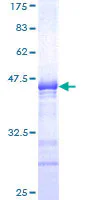 SDS-PAGE - Recombinant Human SOX6 protein (GST tag N-Terminus) (AB153402)