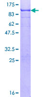 SDS-PAGE - Recombinant Human SOX9 protein (GST tag N-Terminus) (AB131911)